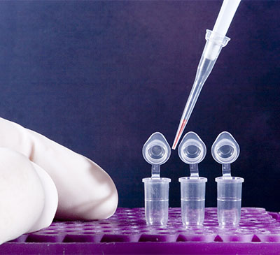 Gene Amplification Technologies Market by Application and Geography - Global Forecast and Analysis 2019-2023